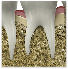 Root Canal Therapy in Spokane, WA