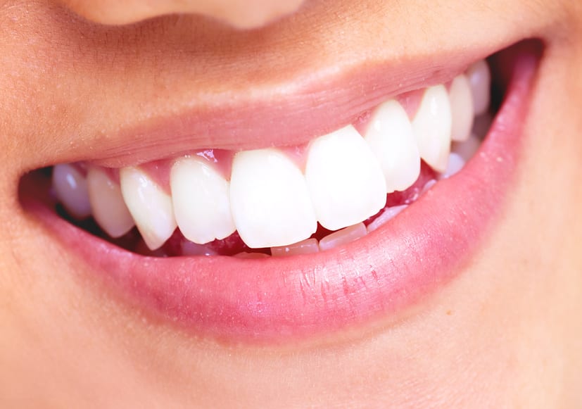 A close up of a bright, white smile